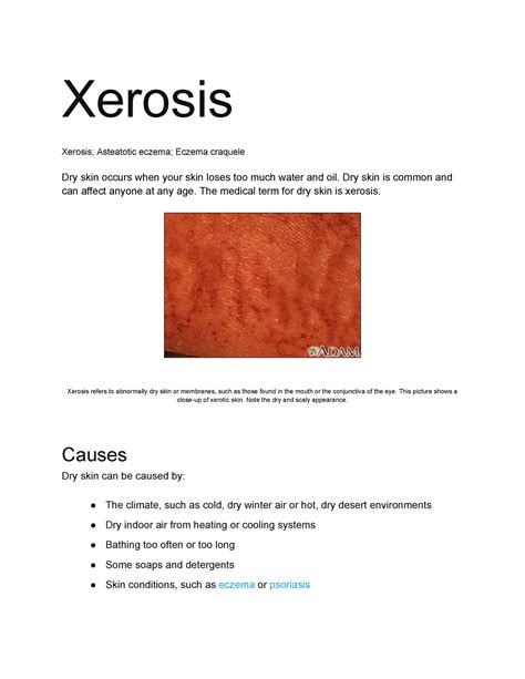 xerosis vs eczema.